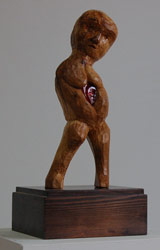 Vulnerability (view 2)